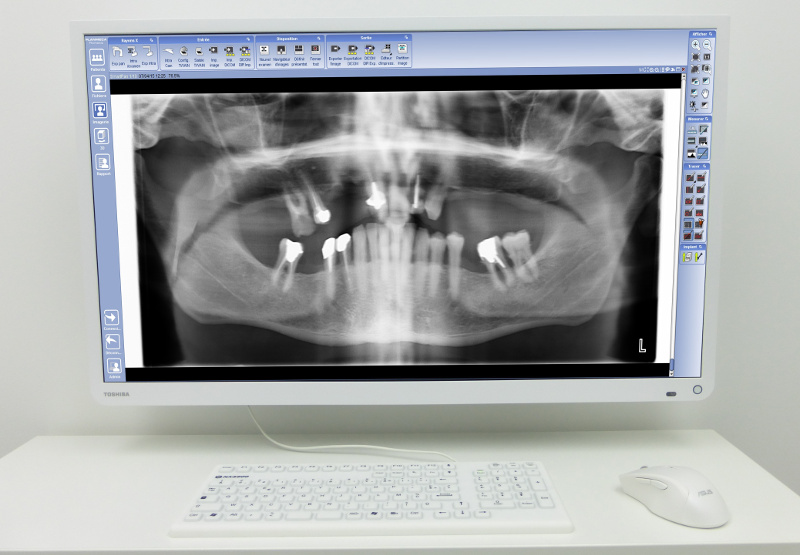 Salle de radiologie-panoramique 3D